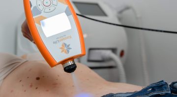 TruCryo-BODY-SCULPTING-COOLSCULPT-CRYO, kassen life,kassen, cryo, targeted cryotherapy, beauty through technology {{brizy_dc_image_alt imageSrc=