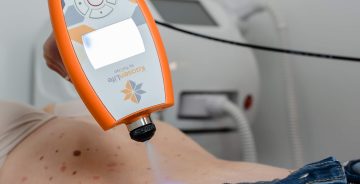 TruCryo-BODY-SCULPTING-COOLSCULPT-CRYO, kassen life,kassen, cryo, targeted cryotherapy, beauty through technology {{brizy_dc_image_alt imageSrc=